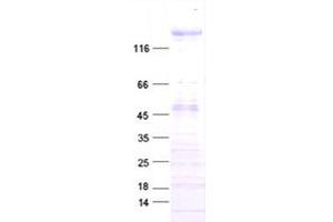 Validation with Western Blot