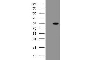 Western Blotting (WB) image for anti-rho GTPase Activating Protein 2 (ARHGAP2) antibody (ABIN1499632) (CHN1 Antikörper)