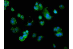 Immunofluorescence staining of MCF-7 cells with ABIN7144607 at 1:166, counter-stained with DAPI. (ARMC1 Antikörper  (AA 28-160))