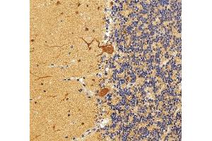 anti-Casein Kinase 2, beta (CSNK2B) (AA 1-215) antibody