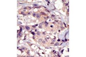 Image no. 1 for anti-Platelet Derived Growth Factor Receptor alpha (PDGFRA) (C-Term) antibody (ABIN359906)