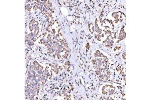IHC analysis of SUCLG1 using anti-SUCLG1 antibody (ABIN7600906). (SUCLG1 Antikörper  (AA 25-346))