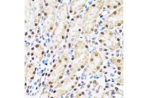Immunohistochemistry of paraffin-embedded mouse kidney using CCAR2 antibody (ABIN5974285) at dilution of 1/100 (40x lens).