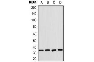 Western blot analysis of CDK2 expression in K562 (A), HeLa (B), NIH3T3 (C), rat heart (D) whole cell lysates. (CDK2 Antikörper  (Center))