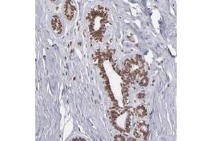 Immunohistochemical staining of human breast with KIAA0020 polyclonal antibody  shows nuclear membranous positivity in glandular cells at 1:50-1:200 dilution. (KIAA0020 Antikörper)
