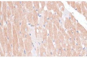 Immunohistochemistry of paraffin-embedded Mouse heart using KATNA1 Polyclonal Antibody at dilution of 1:100 (40x lens).