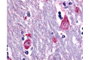 Anti-CHRM3 / M3 antibody IHC of human brain, caudate. (CHRM3 Antikörper  (Cytoplasmic Domain))