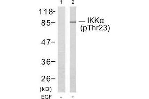 Image no. 2 for anti-conserved Helix-Loop-Helix Ubiquitous Kinase (CHUK) (pThr23) antibody (ABIN196836) (IKK alpha Antikörper  (pThr23))