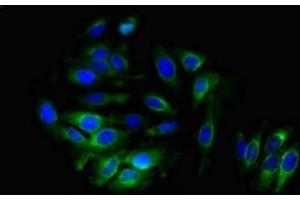 Immunofluorescent analysis of A549 cells using ABIN7143668 at dilution of 1:100 and Alexa Fluor 488-congugated AffiniPure Goat Anti-Rabbit IgG(H+L) (ALDH3B1 Antikörper  (AA 168-449))