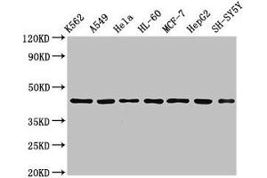 Western Blot Positive WB detected in: K562 whole cell lysate, A549 whole cell lysate, Hela whole cell lysate, HL60 whole cell lyasate, MCF-7 whole cell lysate, HepG2 whole cell lysate, SH-SY5Y whole cell lysate All lanes: TARDBP antibody at 2.