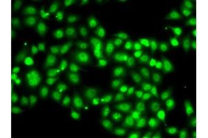 Immunofluorescence analysis of A-549 cells using SETBP1 antibody (ABIN6132919, ABIN6147635, ABIN6147636 and ABIN6223042). (SETBP1 Antikörper  (AA 1-242))