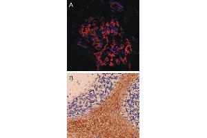 anti-Synaptopodin (SYNPO) (Center) antibody