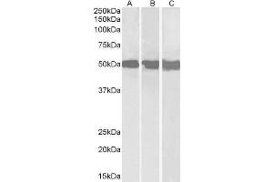 Western Blotting (WB) image for DEAD (Asp-Glu-Ala-Asp) Box Polypeptide 6 (DDX6) peptide (ABIN368790) (DEAD (Asp-Glu-Ala-Asp) Box Polypeptide 6 (DDX6) Peptid)