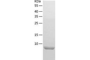 Western Blotting (WB) image for Histatin 3 (HTN3) (AA 20-51) protein (His tag) (ABIN7123336)