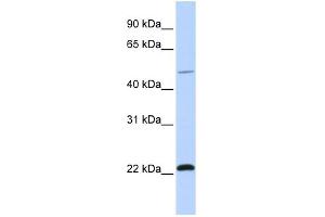 WB Suggested Anti-WWP2 Antibody Titration:  0. (WWP2 Antikörper  (C-Term))