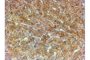 ABIN2613388 (2µg/ml) staining of paraffin embedded Human Liver. (ATG4A Antikörper  (Internal Region))