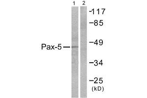 Western Blotting (WB) image for anti-Paired Box 5 (PAX5) (N-Term) antibody (ABIN1848733) (PAX5 Antikörper  (N-Term))