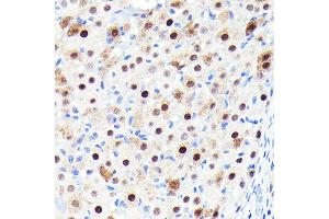 Immunohistochemistry of paraffin-embedded rat ovary using CDKN1B/p27KIP1 Rabbit mAb (ABIN7266602) at dilution of 1:100 (40x lens). (CDKN1B Antikörper)