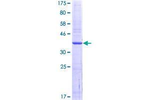 SRPK3 Protein (AA 434-533) (GST tag)