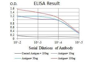 Black line: Control Antigen (100 ng), Purple line: Antigen(10 ng), Blue line: Antigen (50 ng), Red line: Antigen (100 ng), (GSTM1 Antikörper)