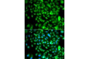 Immunofluorescence analysis of A549 cells using CSRP2BP antibody. (CSRP2BP Antikörper)
