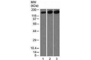 Western blot testing of 1) human HepG2, 2) HeLa and 3) mouse NIH3T3 cell lysate with Topoisomerase II alpha antibody (clone TOP2A/1361). (Topoisomerase II alpha Antikörper  (AA 1352-1493))