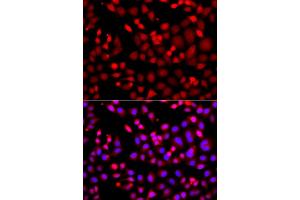 Immunofluorescence analysis of A549 cell using MTUS1 antibody. (MTUS1 Antikörper)