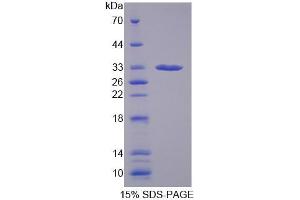 SDS-PAGE (SDS) image for Carbonic Anhydrase XIII (CA13) (AA 1-262) protein (His tag) (ABIN4989706)