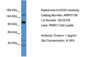 WB Suggested Anti-CCDC87  Antibody Titration: 0. (CCDC87 Antikörper  (C-Term))