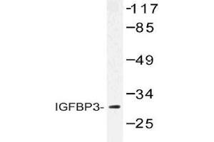Western blot (WB) analysis of IGFBP3 antibody in extracts from HUVEC cells. (IGFBP3 Antikörper)
