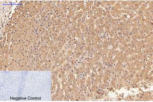 Immunohistochemical analysis of paraffin-embedded human liver tissue.