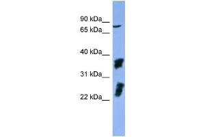 WB Suggested Anti-FGFR2  Antibody Titration: 0. (FGFR2 Antikörper  (C-Term))