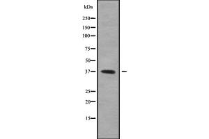 Western blot analysis GFI1B using 293 whole cell lysates (GFI1B Antikörper  (Internal Region))