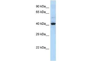 Host: Rabbit Target Name: KRT36 Sample Type: NCI-H226 Whole cell lysates Antibody Dilution: 1. (Keratin 36 Antikörper  (Middle Region))