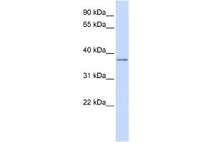 KCNAB2 antibody used at 1 ug/ml to detect target protein. (KCNAB2 Antikörper  (Middle Region))