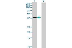 Western Blot analysis of ART4 expression in transfected 293T cell line by ART4 MaxPab polyclonal antibody. (ART4 Antikörper  (AA 1-314))