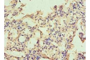 Immunohistochemistry of paraffin-embedded human lung tissue using ABIN7146531 at dilution of 1:100 (CAPNL1 Antikörper  (Catalytic Subunit))