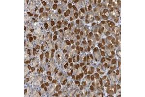 Immunohistochemical staining of human stomach with VTA1 polyclonal antibody  shows strong cytoplasmic positivity in Parietal cells at 1:50-1:200 dilution. (VTA1 Antikörper)