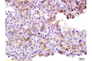Formalin-fixed and paraffin embedded rat melanoma labeled with Anti-SPANX Polyclonal Antibody, Unconjugated (ABIN721675) at 1:200 followed by conjugation to the secondary antibody and DAB staining. (SPANXC Antikörper  (AA 21-97))