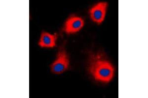 Immunofluorescent analysis of HSPE1 staining in NIH3T3 cells. (HSPE1 Antikörper  (Center))