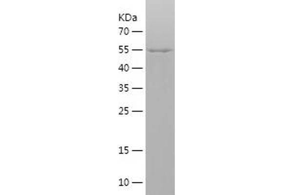 Cullin 1 Protein (CUL1) (AA 477-776) (His-IF2DI Tag)