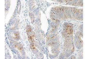 Image no. 2 for anti-Chemokine (C-C Motif) Ligand 20 (CCL20) antibody (ABIN465457) (CCL20 Antikörper)