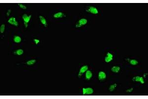 Immunofluorescent analysis of Hela cells using ABIN7155745 at dilution of 1:100 and Alexa Fluor 488-congugated AffiniPure Goat Anti-Rabbit IgG(H+L) (HOXC11 Antikörper  (AA 10-304))