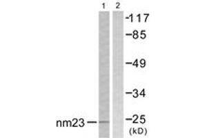 Western blot analysis of extracts from K562 cells, using NM23 Antibody. (NME1 Antikörper  (AA 91-140))