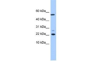 WB Suggested Anti-DPH4 Antibody Titration: 0. (DNAJC24 Antikörper  (N-Term))
