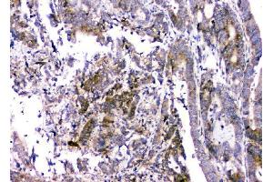 IHC analysis of RMI2 using anti-RMI2 antibody (ABIN6719656).