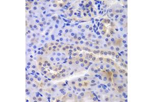 Immunohistochemistry of paraffin-embedded mouse kidney using PSMA6 antibody (ABIN6292835) at dilution of 1:100 (40x lens).