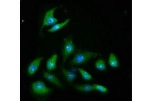 Immunofluorescence staining of A549 cells with ABIN7167028 at 1:466, counter-stained with DAPI. (AKT2 Antikörper  (AA 2-481))