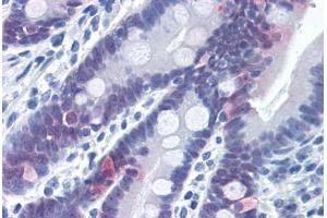 Human Small Intestine (formalin-fixed, paraffin-embedded) stained with CASP6 antibody ABIN337396 at 5 ug/ml followed by biotinylated goat anti-rabbit IgG secondary antibody ABIN481713, alkaline phosphatase-streptavidin and chromogen. (Caspase 6 Antikörper  (Cleavage Site))