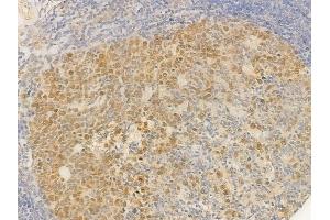 ABIN6255330 and ABIN6277725 at 1/100 staining human normal tonsil tissue by IHC-P. (ATR Antikörper  (pSer428))